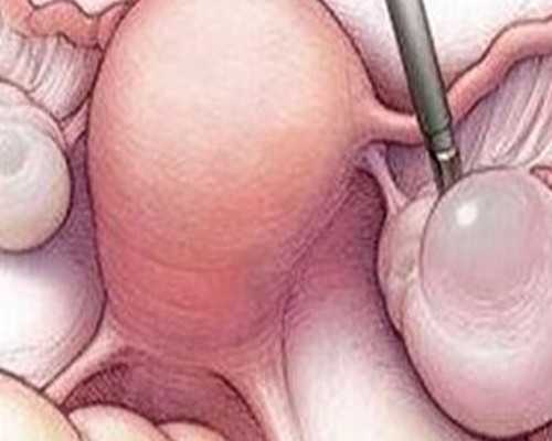 试管婴儿医院选择指南与高成功率机构推荐