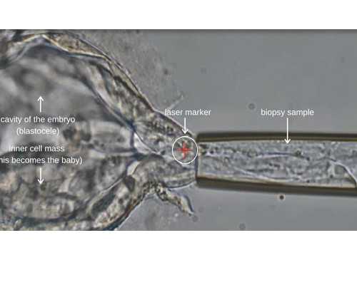 江西精子库冷冻精子费用解析与辅助生殖服务指南